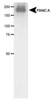 Western Blot: FACA/FANCA Antibody [NB100-2564]