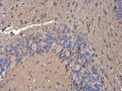 Immunohistochemistry-Paraffin: FACL4 Antibody (GT186) [NBP3-13533]