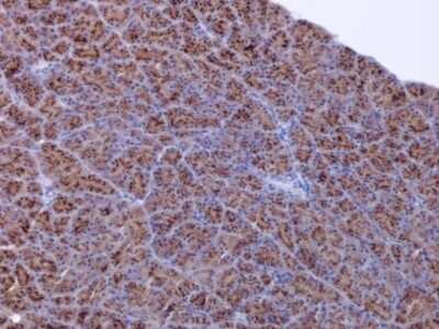 Immunohistochemistry-Paraffin: FACL4 Antibody (GT566) [NBP3-13526]