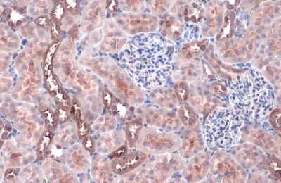 Immunohistochemistry-Paraffin: FACL4 Antibody (HL229) [NBP3-13666]