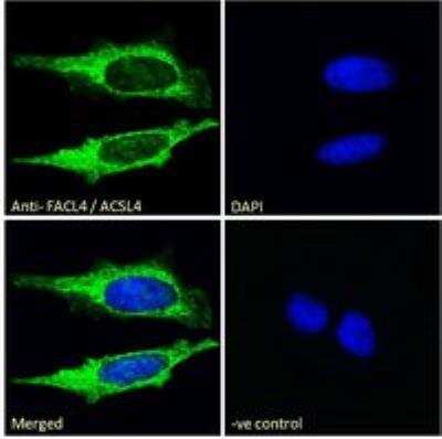 Immunocytochemistry/ Immunofluorescence: FACL4 Antibody [NB300-861]