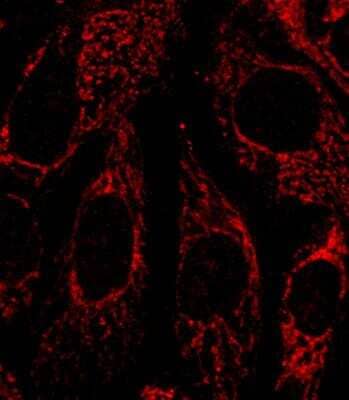Immunocytochemistry/ Immunofluorescence: FACL4 Antibody [NBP2-16401]