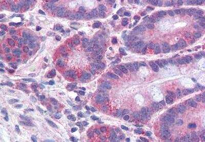 Immunohistochemistry-Paraffin: FACL4 Antibody [NB300-861]