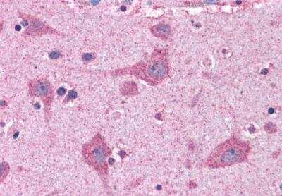 Immunohistochemistry-Paraffin: FACL4 Antibody [NB300-861]