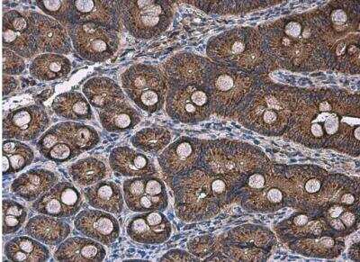 Immunohistochemistry-Paraffin: FACL4 Antibody [NBP2-16400]