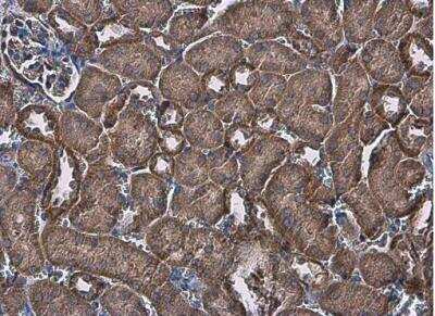 Immunohistochemistry-Paraffin: FACL4 Antibody [NBP2-16400]
