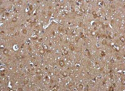 Immunohistochemistry-Paraffin: FACL4 Antibody [NBP2-16401]