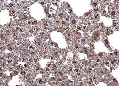 Immunohistochemistry-Paraffin: FACL4 Antibody [NBP2-16401]