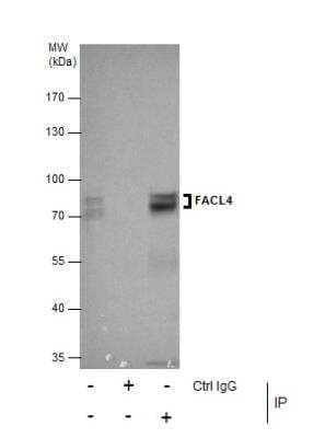 Immunoprecipitation: FACL4 Antibody [NBP2-16401]