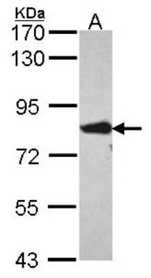 Western Blot: FACL4 Antibody [NBP2-16400]