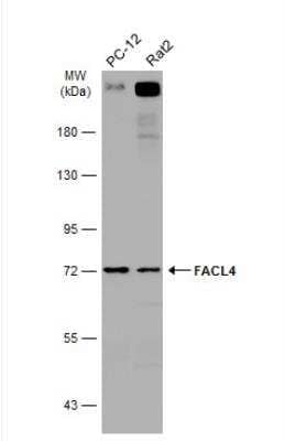 Western Blot: FACL4 Antibody [NBP2-16400]
