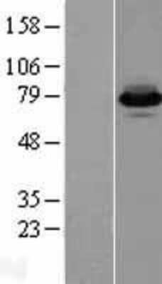 Western Blot: FACL4 Overexpression Lysate [NBL1-07264]