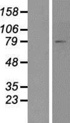 Western Blot: FACL4 Overexpression Lysate [NBP2-06367]