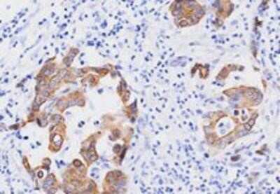 Immunohistochemistry-Paraffin: FADD Antibody (J1D2) - BSA Free [NBP1-04288]