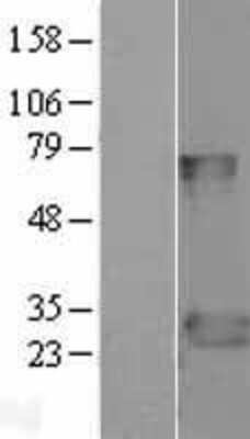 Western Blot: FADD Overexpression Lysate [NBL1-10424]