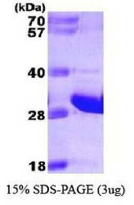 SDS-PAGE: Recombinant Human FADD His Protein [NBP1-30266]