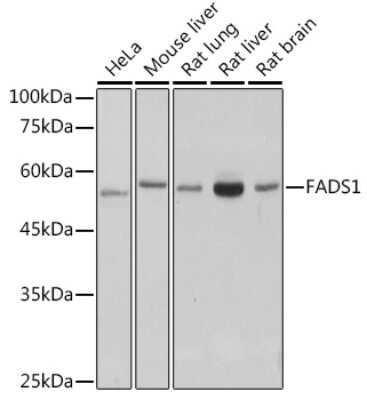 Western Blot: FADS1 Antibody (1M8L2) [NBP3-15253]