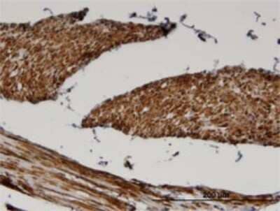 Immunohistochemistry-Paraffin: FADS1 Antibody (2D9) [H00003992-M04]