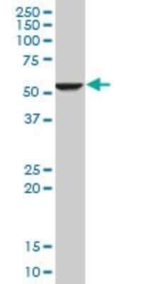 Western Blot: FADS1 Antibody (2D9) [H00003992-M04]