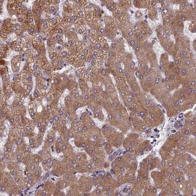 Immunohistochemistry-Paraffin: FADS1 Antibody [NBP1-84312]