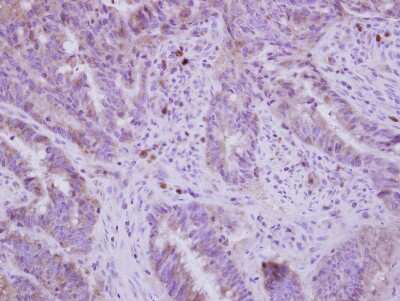 Immunohistochemistry-Paraffin: FADS1 Antibody [NBP2-16407]