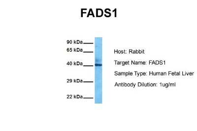 Western Blot: FADS1 Antibody [NBP1-60085]