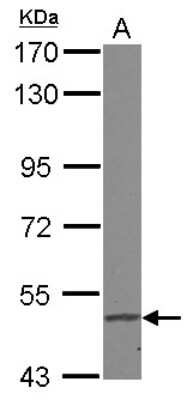 Western Blot: FADS1 Antibody [NBP2-16407]