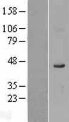 Western Blot: FADS1 Overexpression Lysate [NBL1-10425]