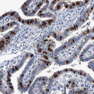 Immunohistochemistry: FADS6 Antibody [NBP2-14490]