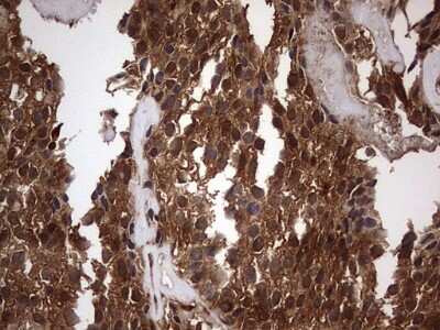 Immunohistochemistry: FAF1 Antibody (OTI10D1) [NBP2-45565]