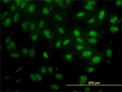 Immunocytochemistry/ Immunofluorescence: FAF1 Antibody (1A10) [H00011124-M01]