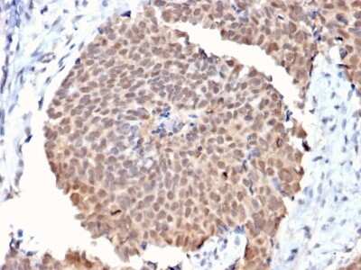 Immunohistochemistry-Paraffin: FAF1 Antibody (CPTC-FAF1-2) - Azide and BSA Free [NBP3-08227]