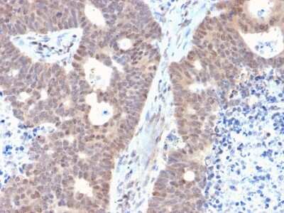 Immunohistochemistry-Paraffin: FAF1 Antibody (CPTC-FAF1-2) - Azide and BSA Free [NBP3-08227]