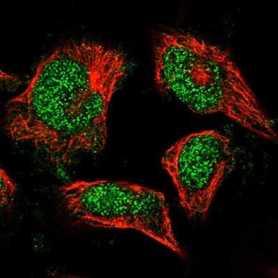 Immunocytochemistry/ Immunofluorescence: FAF1 Antibody [NBP1-84527]