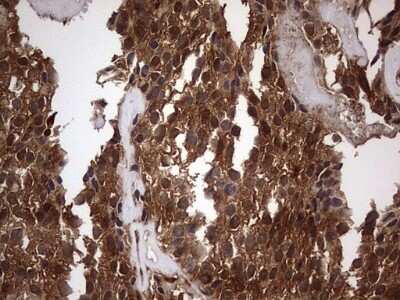 Immunohistochemistry: FAF1 Antibody (OTI10D1) - Azide and BSA Free [NBP2-71679]