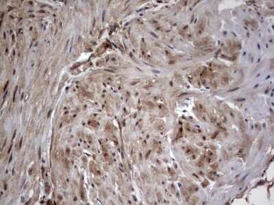 Immunohistochemistry: FAF1 Antibody (OTI10D1) - Azide and BSA Free [NBP2-71679]