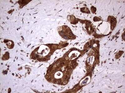 Immunohistochemistry: FAF1 Antibody (OTI10D1) - Azide and BSA Free [NBP2-71679]