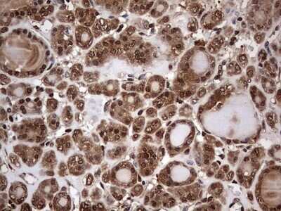 Immunohistochemistry: FAF1 Antibody (OTI10D1) - Azide and BSA Free [NBP2-71679]