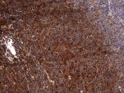 Immunohistochemistry: FAF1 Antibody (OTI10D1) - Azide and BSA Free [NBP2-71679]