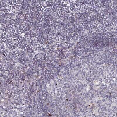 Immunohistochemistry-Paraffin: FAHD1 Antibody [NBP2-58331]