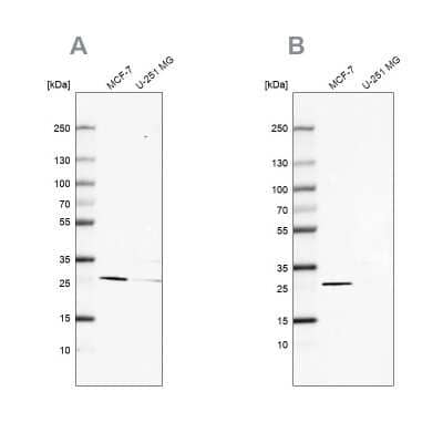 Western Blot: FAHD1 Antibody [NBP2-58331]