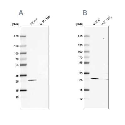 Western Blot: FAHD1 Antibody [NBP2-58743]