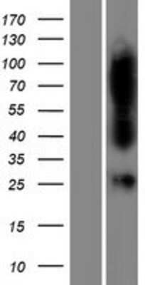 Western Blot: FAHD1 Overexpression Lysate [NBP2-08665]