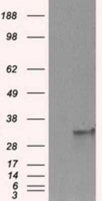 Western Blot: FAHD2A Antibody (OTI6D9)Azide and BSA Free [NBP2-71886]