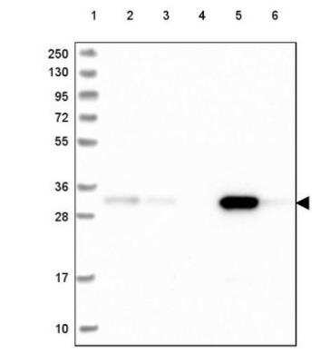 Western Blot: FAHD2A Antibody [NBP2-54694]