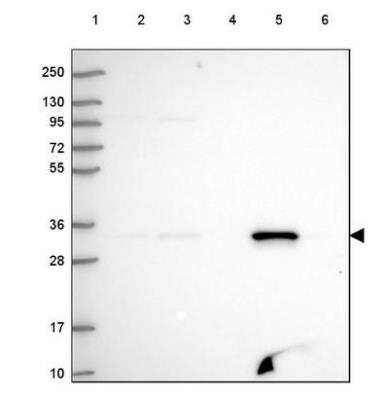 Western Blot: FAHD2A Antibody [NBP2-54717]