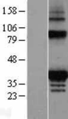 Western Blot: FAHD2A Overexpression Lysate [NBL1-10429]