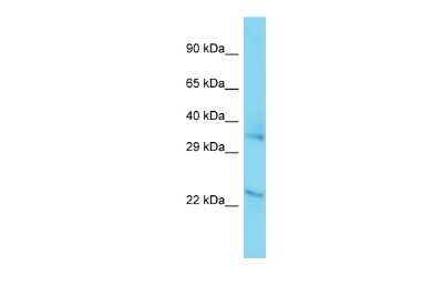 Western Blot: FAHD2B Antibody [NBP3-09411]