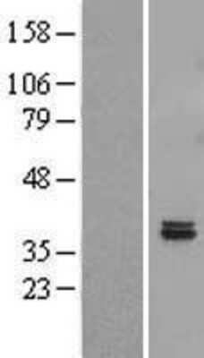 Western Blot: FAHD2B Overexpression Lysate [NBL1-10430]