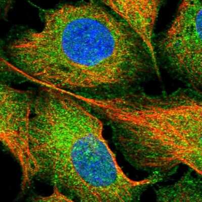 Immunocytochemistry/ Immunofluorescence: FAIM1 Antibody [NBP2-48764]